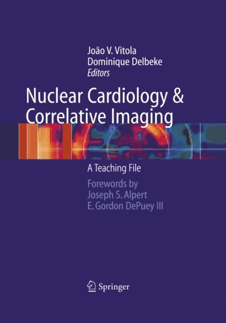 Dominique Delbeke, Joao V. Vitola - Nuclear Cardiology and Correlative Imaging, E-bok