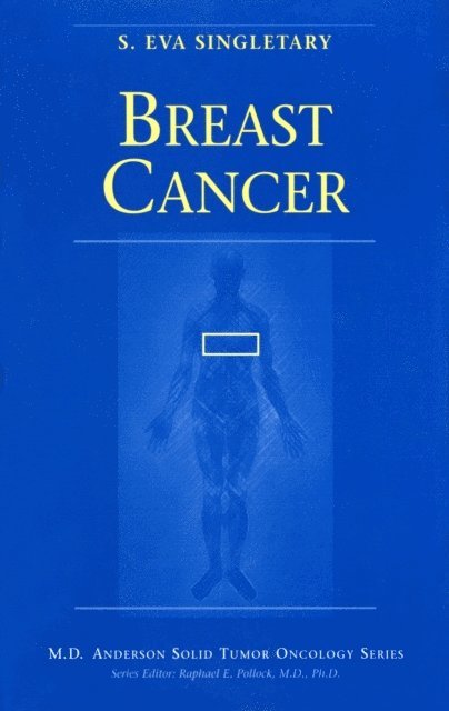S. Eva Singletary - Breast Cancer, E-bok