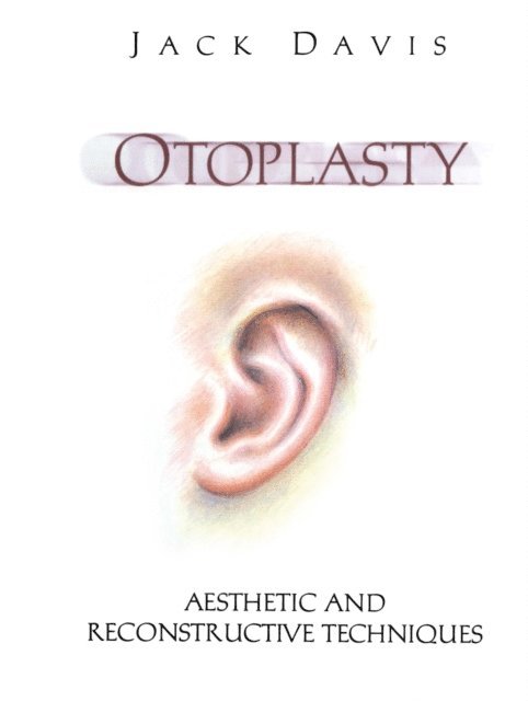 Jack Davis - Otoplasty, E-bok