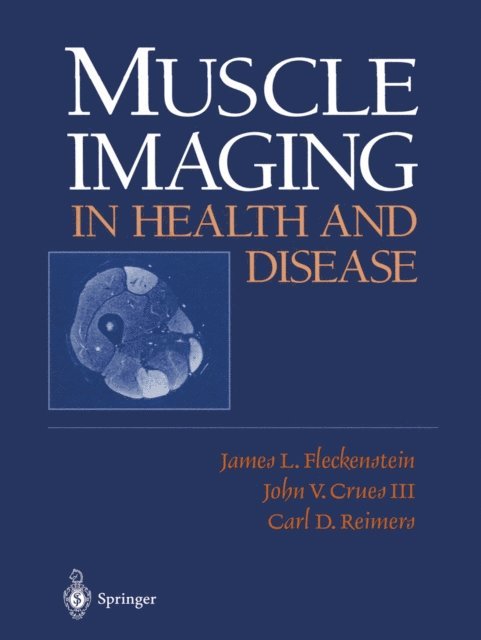 C.D. Reimers, John V. III Crues, James L. Fleckenstein - Muscle Imaging in Health and Disease, E-bok