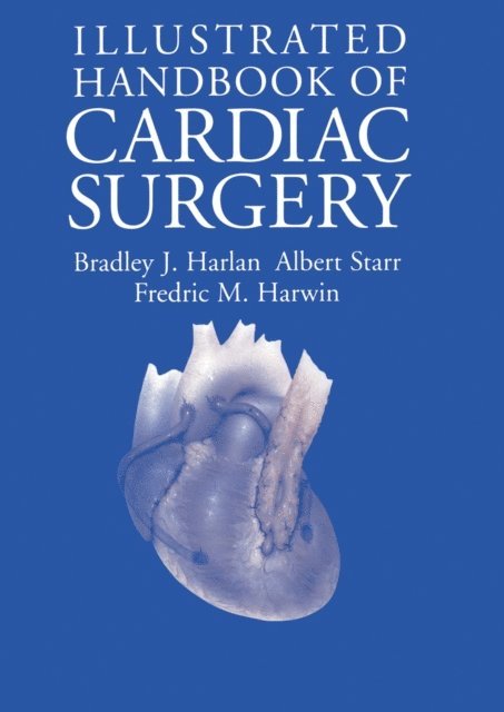 Fredric M. Harwin, Albert Starr, Bradley J. Harlan - Illustrated Handbook of Cardiac Surgery, E-bok