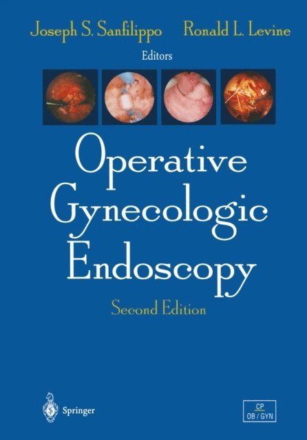 Roland L. Levine, Joseph S. Sanfilippo - Operative Gynecologic Endoscopy, E-bok