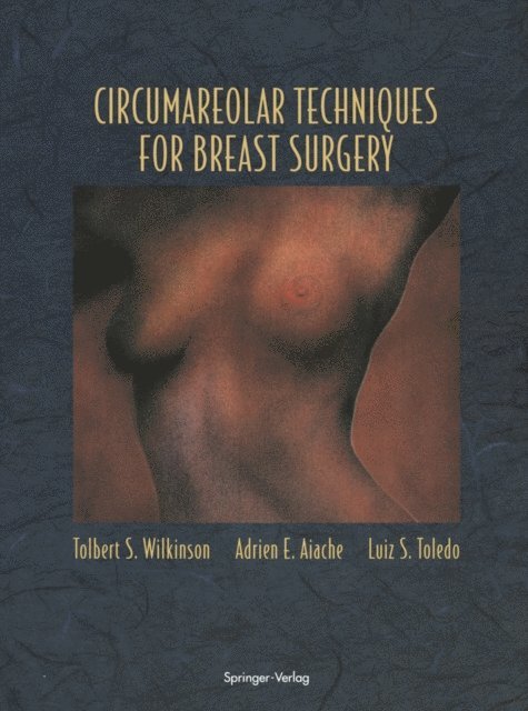 Luiz S. Toledo, Adrien E. Aiache, Tolbert S. Wilkinson - Circumareolar Techniques for Breast Surgery, E-bok