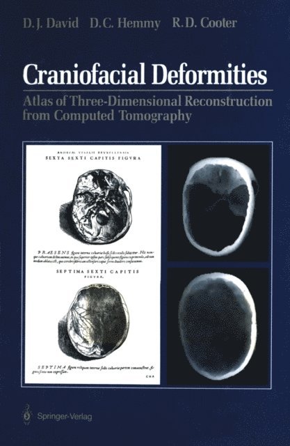 Rodney D. Cooter, David C. Hemmy, David J. David - Craniofacial Deformities, E-bok. Tillgänglighet: Lägg i varukorg