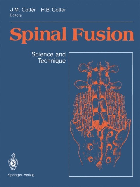 Howard B. Cotler, Jerome M. Cotler - Spinal Fusion, E-bok. Tillgänglighet: Lägg i varukorg