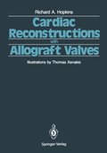 Cardiac Reconstructions with Allograft Valves