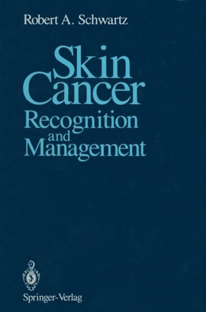 Robert A. Schwartz - Skin Cancer, E-bok