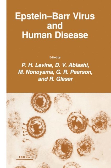 R. Glaser, G. R. Pearson, M. Nonoyama, D. V. Ablashi, P. H. Levine - Epstein-Barr Virus and Human Disease, E-bok