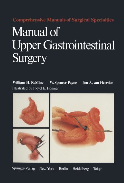 Jon A. van Heerden, W. Spencer Payne, William H. ReMine - Manual of Upper Gastrointestinal Surgery, E-bok
