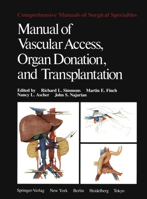 J.S. Najarian, N.L. Ascher, M.E. Finch, R.L. Simmons - Manual of Vascular Access, Organ Donation, and Transplantation, E-bok