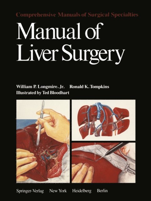 R.K. Tompkins, W.P. Longmire - Manual of Liver Surgery, E-bok. Tillgänglighet: Lägg i varukorg