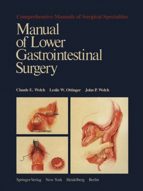 John P. Welch, Leslie W. Ottinger, Claude E. Welch - Manual of Lower Gastrointestinal Surgery, E-bok