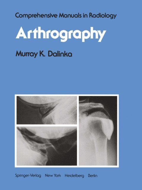 M. K. Dalinka - Arthrography, E-bok