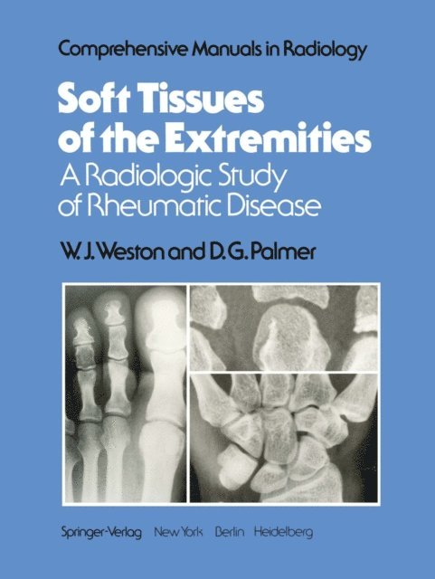 D. G. Palmer, W. J. Weston - Soft Tissues of the Extremities, E-bok