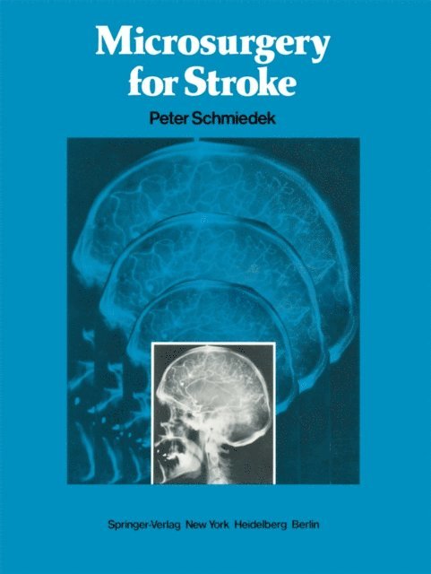 R.F Spetzler, O. Gratzl, P. Schmiedek - Microsurgery for Stroke, E-bok