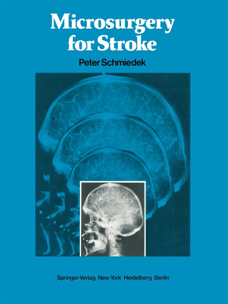 P. Schmiedek, O. Gratzl, R.F Spetzler - Microsurgery for Stroke, Häftad