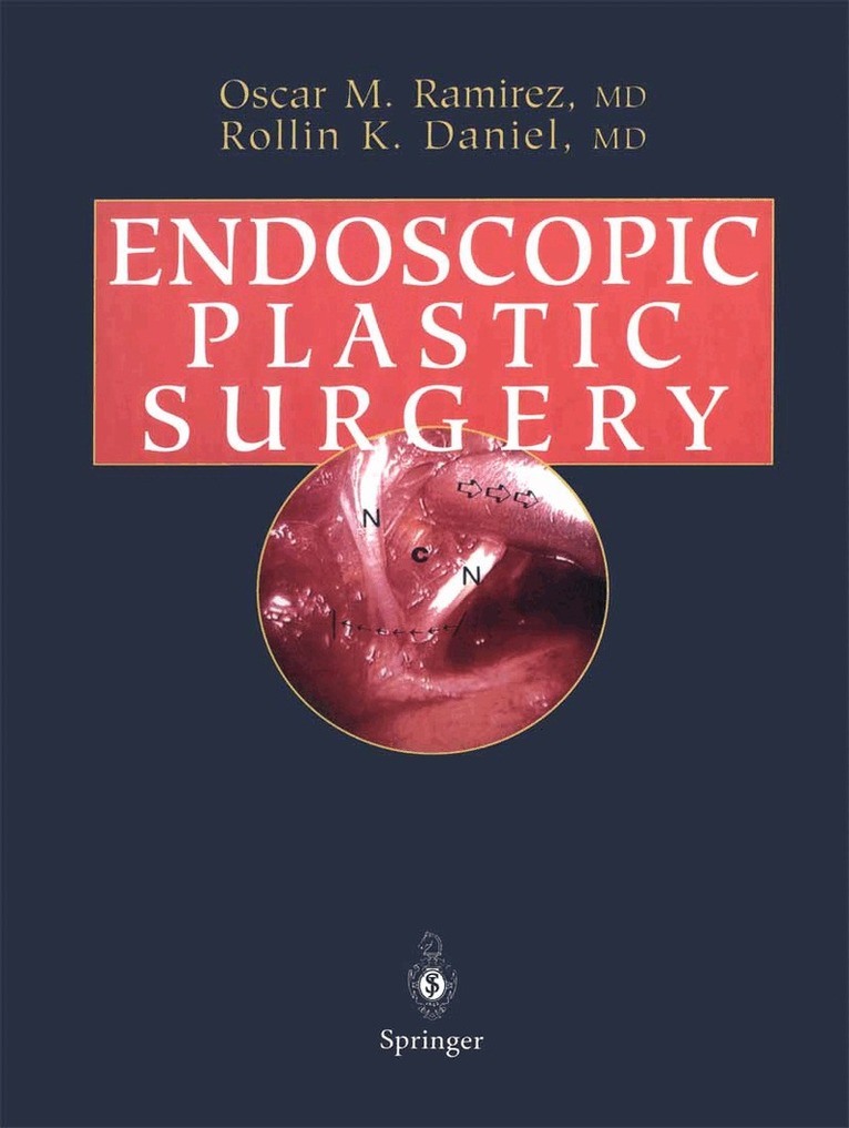 Oscar M. Ramirez, Rollin K. Daniel - Endoscopic Plastic Surgery, Häftad
