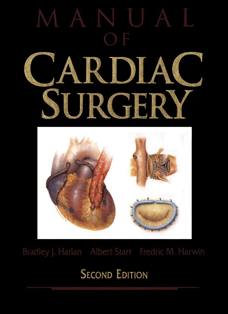Bradley J. Harlan, Albert Starr, Fredric M. Harwin - Manual of Cardiac Surgery, Häftad