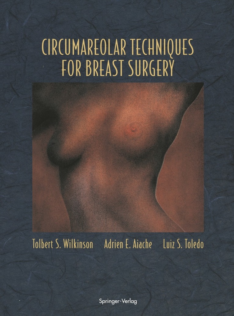 Tolbert S. Wilkinson, Adrien E. Aiache, Luiz S. Toledo - Circumareolar Techniques for Breast Surgery, Häftad