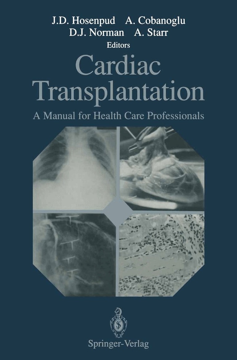 Jeffrey D. Hosenpud, Adnan Cobanoglu, Douglas J. Norman, Albert Starr - Cardiac Transplantation, Häftad