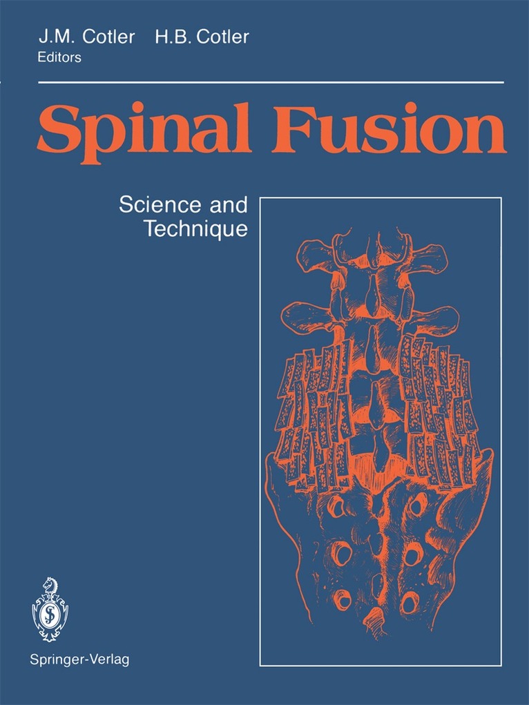 Jerome M. Cotler, Howard B. Cotler - Spinal Fusion, Häftad. Tillgänglighet: Lägg i varukorg