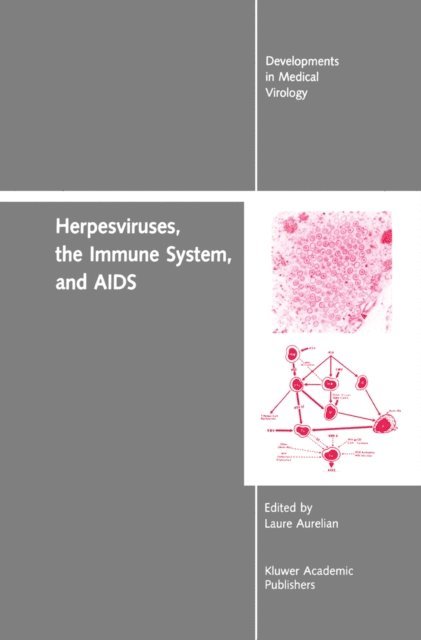 Yechiel Becker, Laure Aurelian - Herpesviruses, the Immune System, and AIDS, E-bok