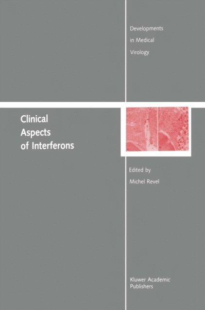 Michel Revel - Clinical Aspects of Interferons, E-bok