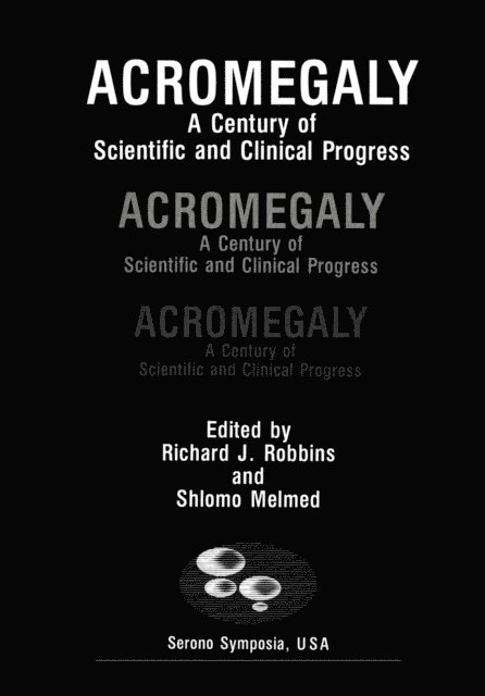 Richard J. Robbins - Acromegaly, E-bok