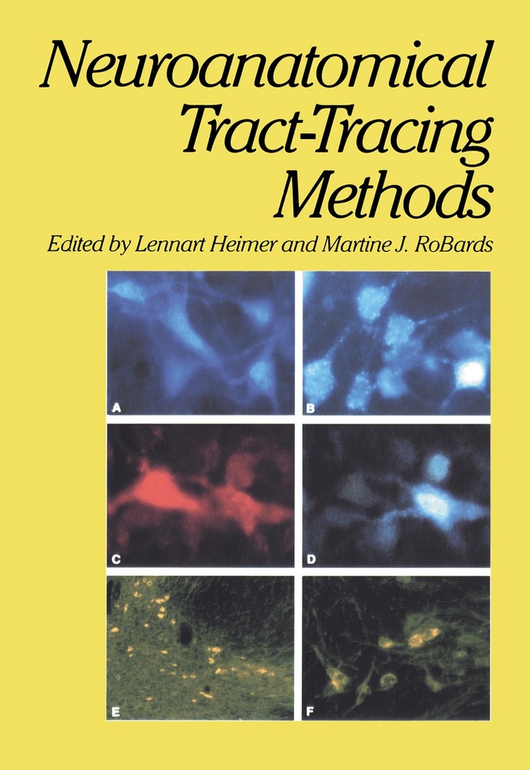 Lennart Heimer, Martine J. Robards - Neuroanatomical Tract-Tracing Methods, Häftad. Tillgänglighet: Lägg i varukorg