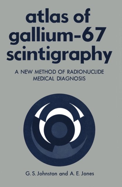 Gerald Johnston - Atlas of Gallium-67 Scintigraphy, E-bok