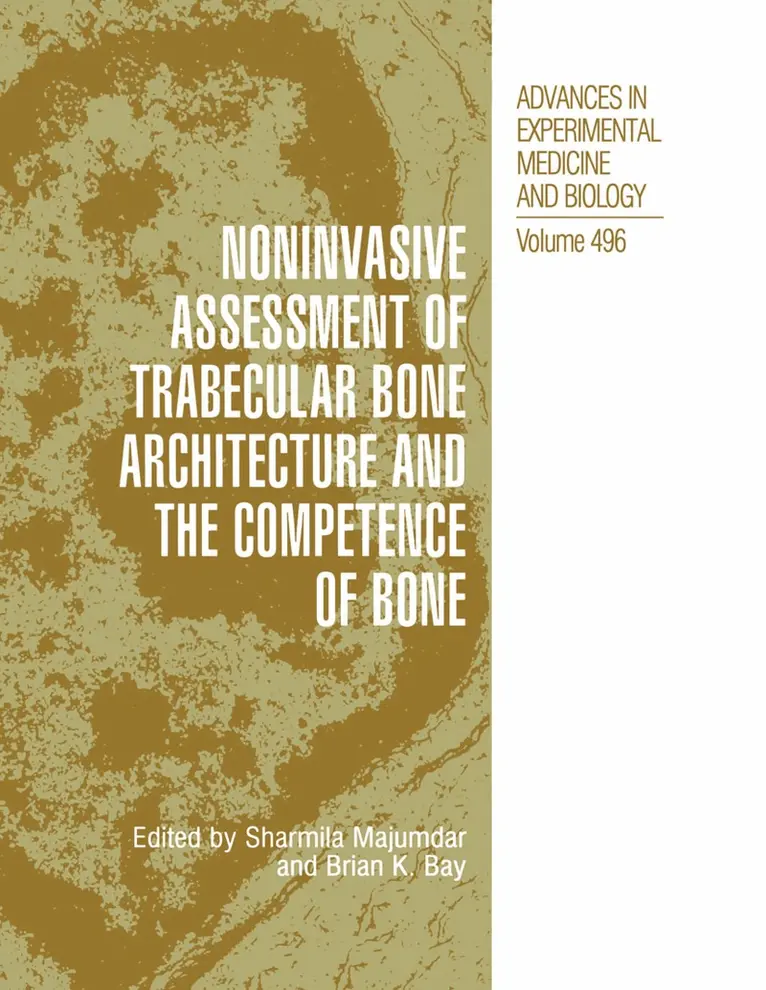 Sharmila Majumdar, Brian K. Bay - Noninvasive Assessment of Trabecular Bone Architecture and The Competence of Bone, Häftad. Tillgänglighet: Lägg i varukorg
