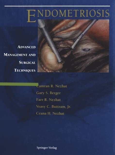 Ceana H. Nezhat, Veasy C. Jr. Buttram, Farr Nezhat, Gary S. Berger, Camran R. Nezhat - Endometriosis, E-bok