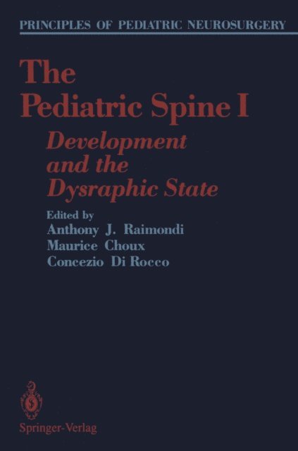 Concezio Di Rocco, Maurice Choux, Anthony J. Raimondi - Pediatric Spine I, E-bok
