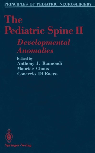 Concezio Di Rocco, Maurice Choux, Anthony J. Raimondi - Pediatric Spine II, E-bok