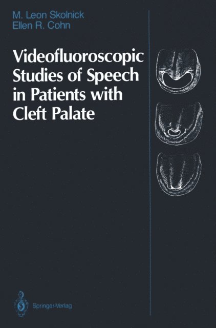 Ellen R. Cohn, M. Leon Skolnick - Videofluoroscopic Studies of Speech in Patients with Cleft Palate, E-bok