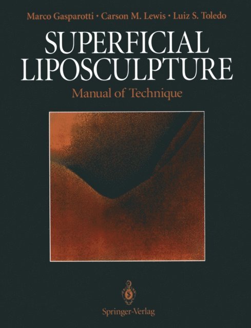 Luiz S. Toledo, Carson M. Lewis, Marco Gasparotti - Superficial Liposculpture, E-bok