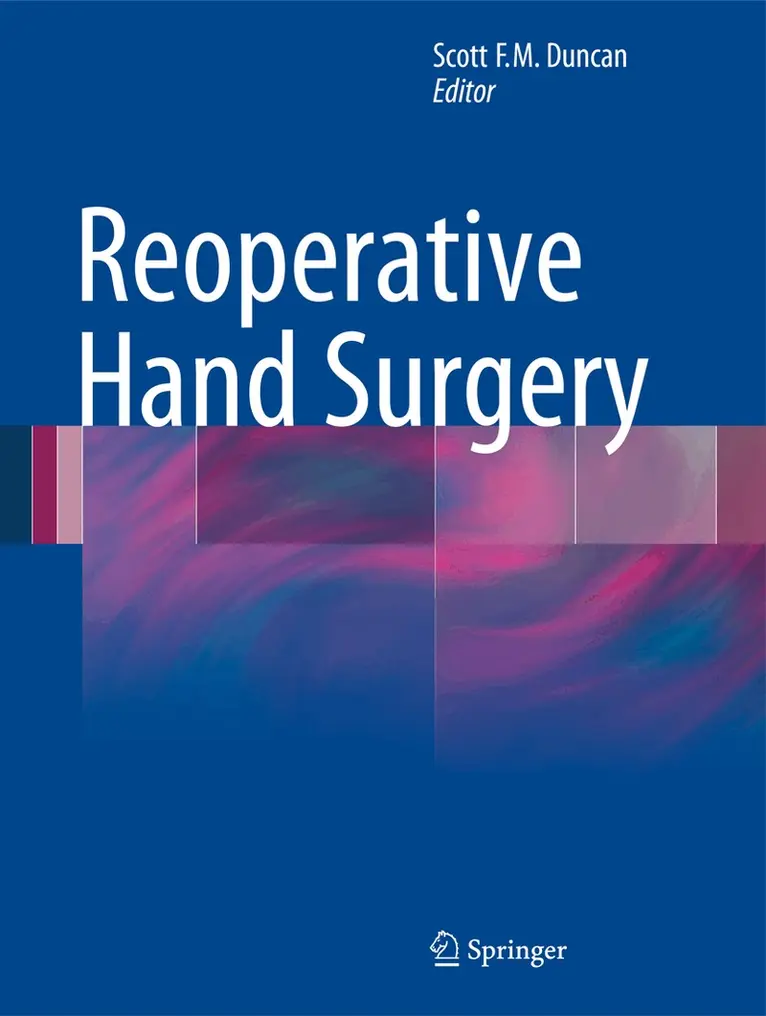 Scott F.M. Duncan - Reoperative Hand Surgery, Inbunden. Tillgänglighet: Lägg i varukorg