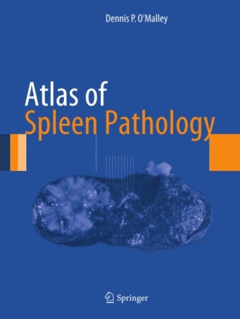 Dennis P. O'Malley - Atlas of Spleen Pathology, E-bok