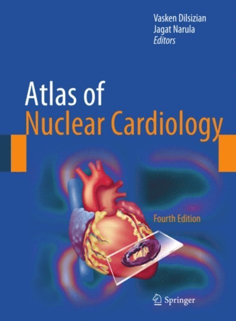 Jagat Narula, Vasken Dilsizian - Atlas of Nuclear Cardiology, E-bok