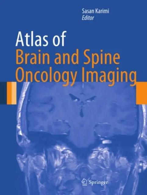Sasan Karimi - Atlas of Brain and Spine Oncology Imaging, E-bok. Tillgänglighet: Lägg i varukorg