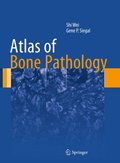 Atlas of Bone Pathology