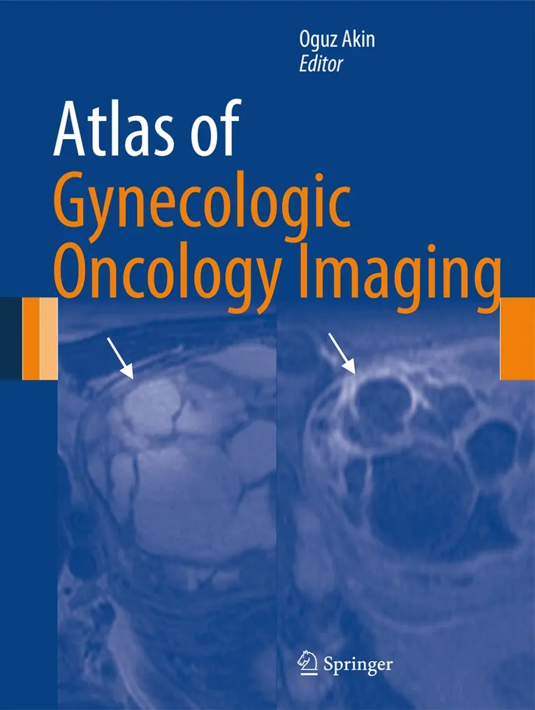 Oguz Akin - Atlas of Gynecologic Oncology Imaging, Inbunden. Tillgänglighet: Lägg i varukorg