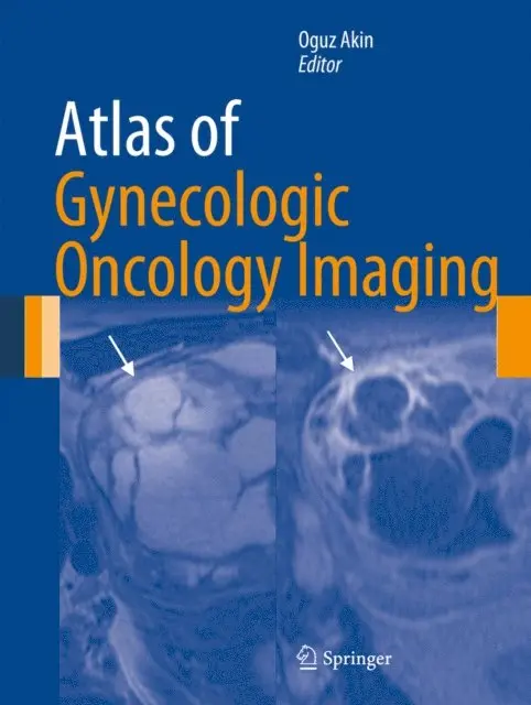 Oguz Akin - Atlas of Gynecologic Oncology Imaging, E-bok. Tillgänglighet: Lägg i varukorg