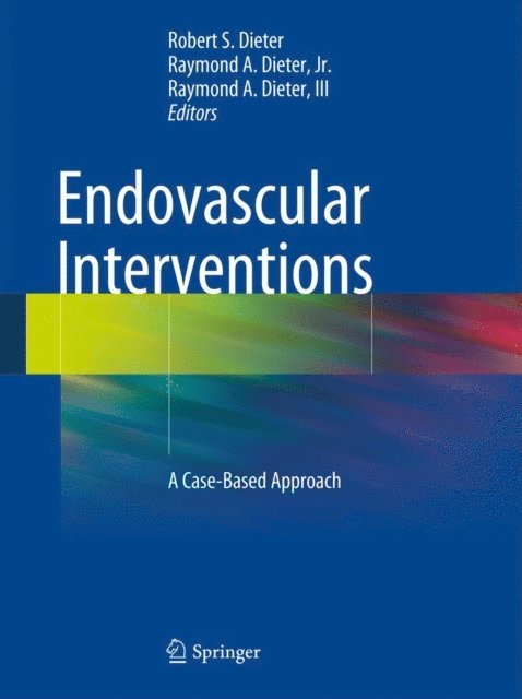 Raymond A. Dieter, III, Raymond A. Dieter, Jr., Robert S. Dieter - Endovascular Interventions, E-bok