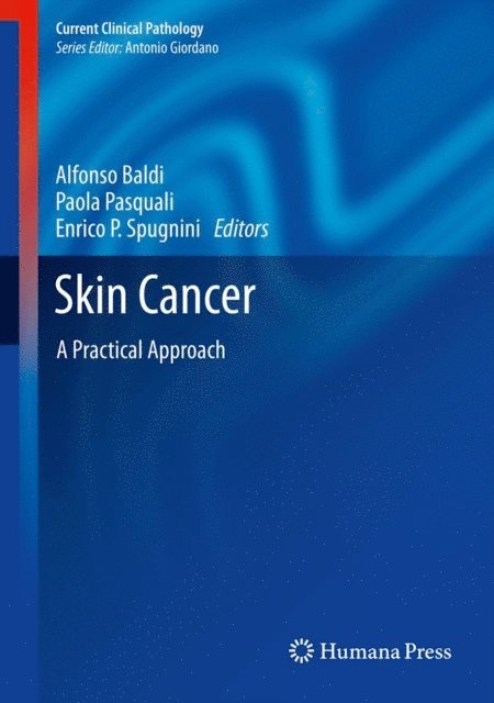 Enrico P Spugnini, Paola Pasquali, Alfonso Baldi - Skin Cancer, E-bok