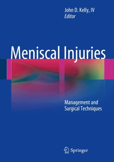 John D. Kelly, IV - Meniscal Injuries, E-bok. Tillgänglighet: Lägg i varukorg