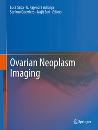 Ovarian Neoplasm Imaging