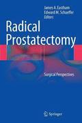 Radical Prostatectomy
