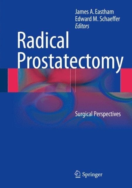 Edward M. Schaeffer, James A. Eastham - Radical Prostatectomy, E-bok