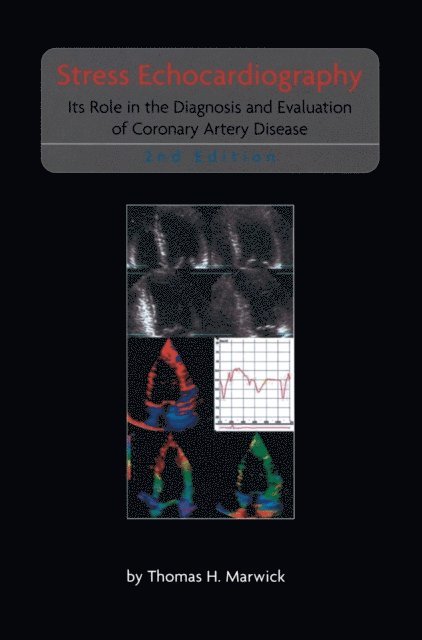 Thomas H. Marwick - Stress Echocardiography, E-bok